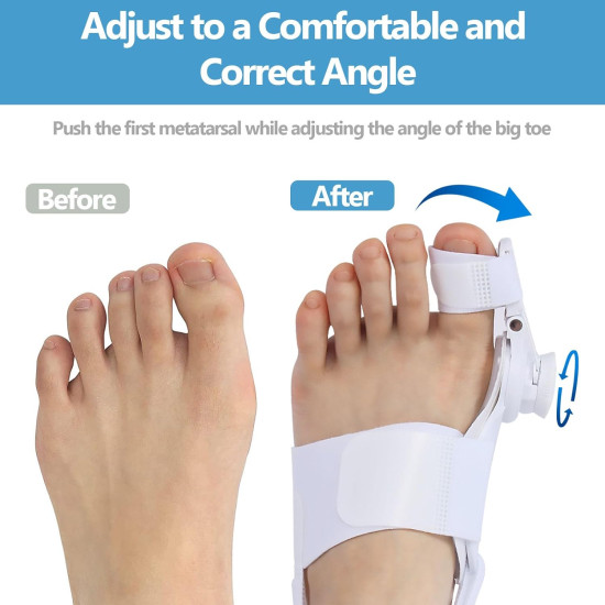 Bunion Splint Big Toe Straightener Corrector