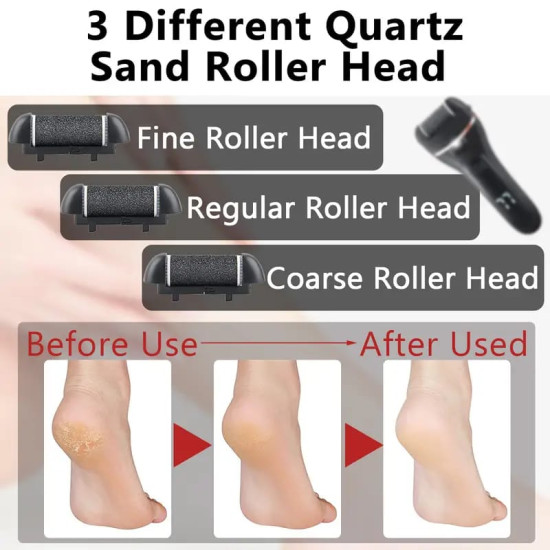 Premium Rechargeable Foot File (Callus Remover)